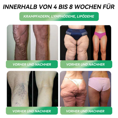 STDEI® GLP-1 Orale Lösung 🌿 Nur eine Dosis pro Tag – nach 7 Tagen sehen Sie bereits sichtbare Veränderungen ✅ Für Adipositas, Herz-Kreislauf, Diabetes, Schlafapnoe, Gelenke und mehr🌺